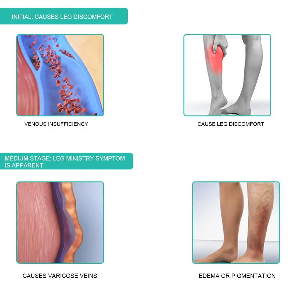 1Pair Medical Compression Sock - đánh giá và giá Compression Sleeve Calf
