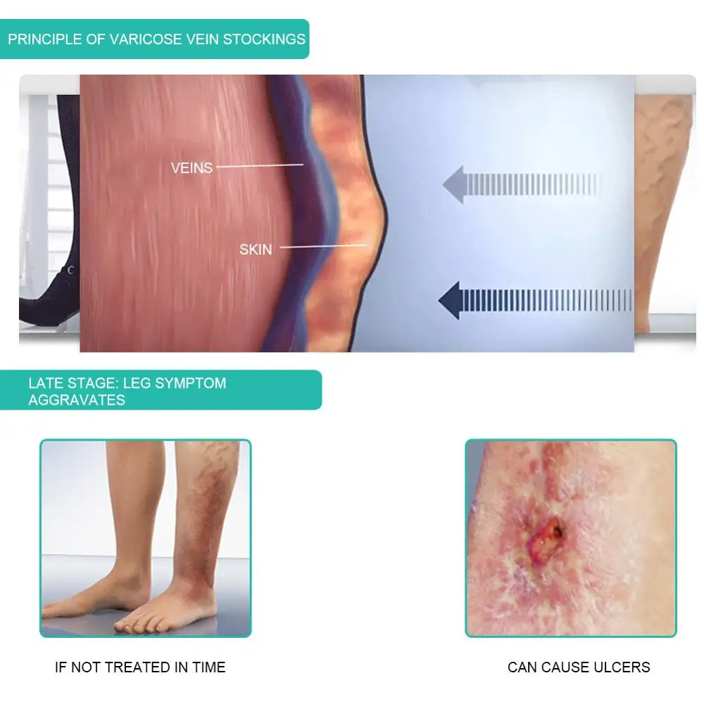 1Pair Medical Compression Sock - đánh giá và giá Compression Sleeve Calf